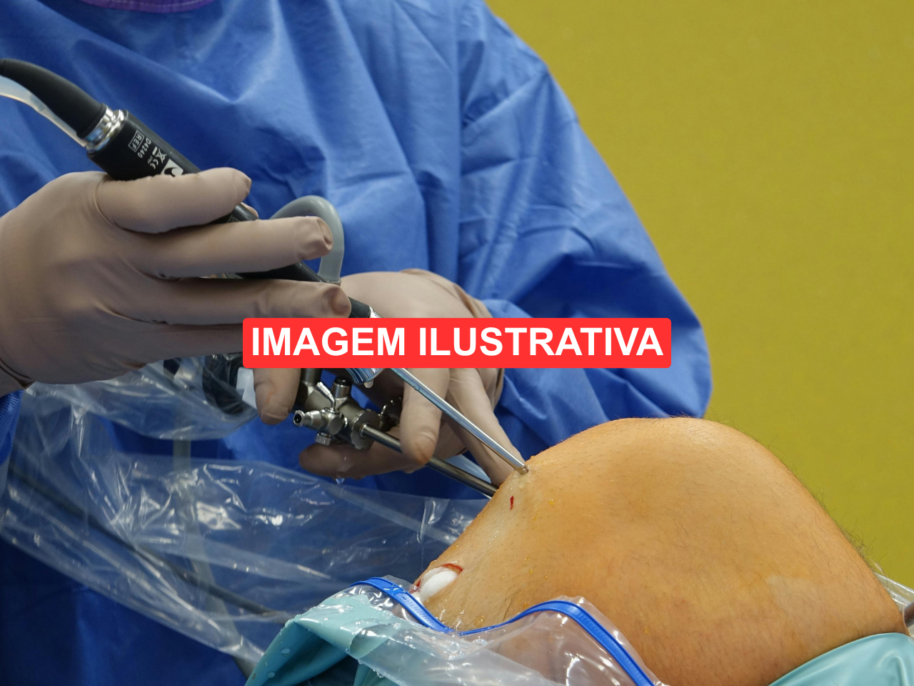 Medico-Realizando-Procedimentos-de-Cirurgia-2-ilustrativa
