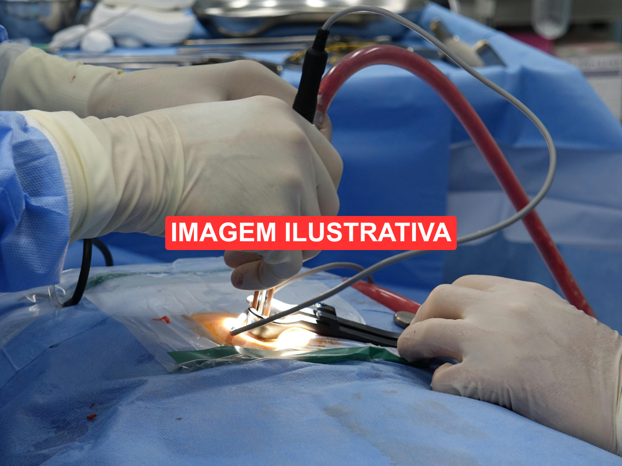 Medico-Realizando-Procedimentos-de-Cirurgia-3-ilustrativa