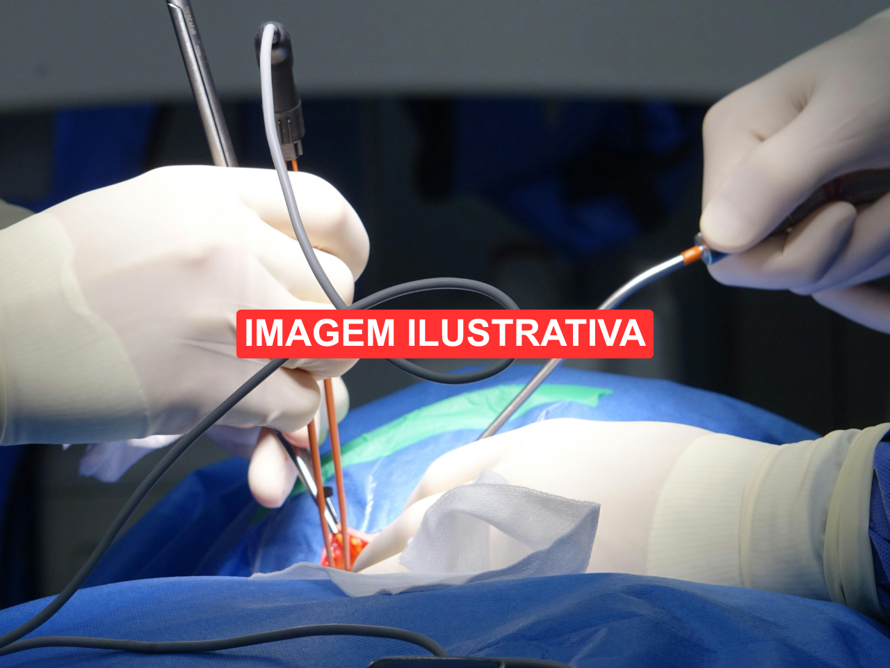 Medico-Realizando-Procedimentos-de-Cirurgia-ilustrativa